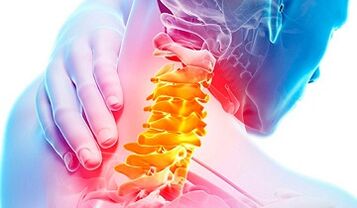 Mugurkaula kakla mugurkaula osteohondrozes pazīmes