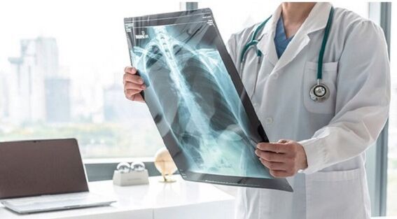 Rentgena diagnostika sāpēm zem kreisās lāpstiņas