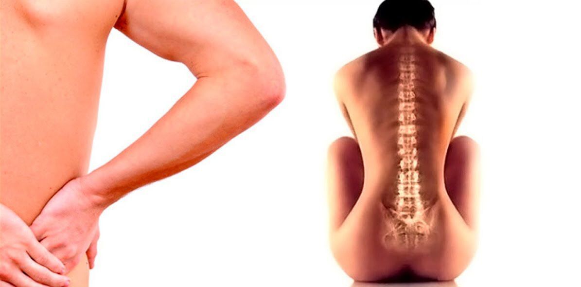sāpes muguras lejasdaļā osteohondrozes dēļ