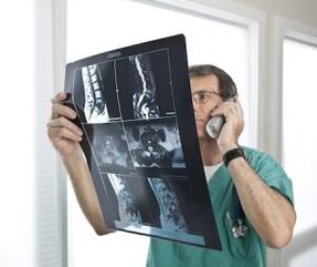 Mielogrāfija osteohondrozes un starpskriemeļu trūču diagnostikai